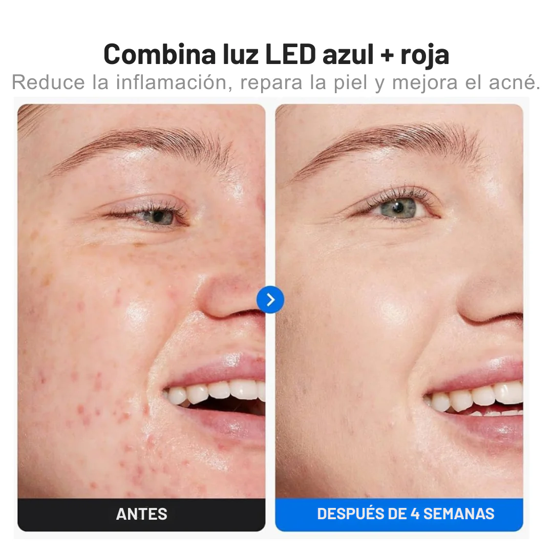 Máscara de Luz LED Facial
